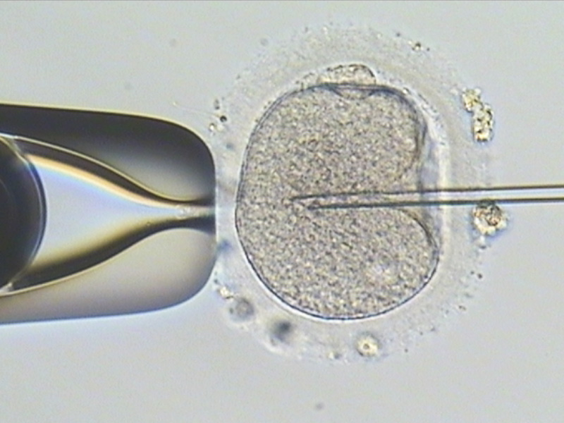 單一精蟲顯微授精術-嘉安試管嬰兒中心,不孕症,試管嬰兒,人工受孕,冷凍卵子